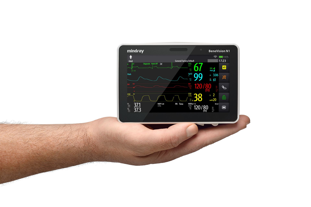 Monitor Mindray BeneVision N1 para monitorización durante el traslado intrahospitalario