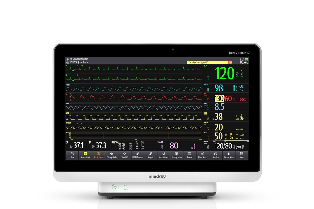 Monitor de paciente Mindray BeneVision N17 de 18.5 pulgadas